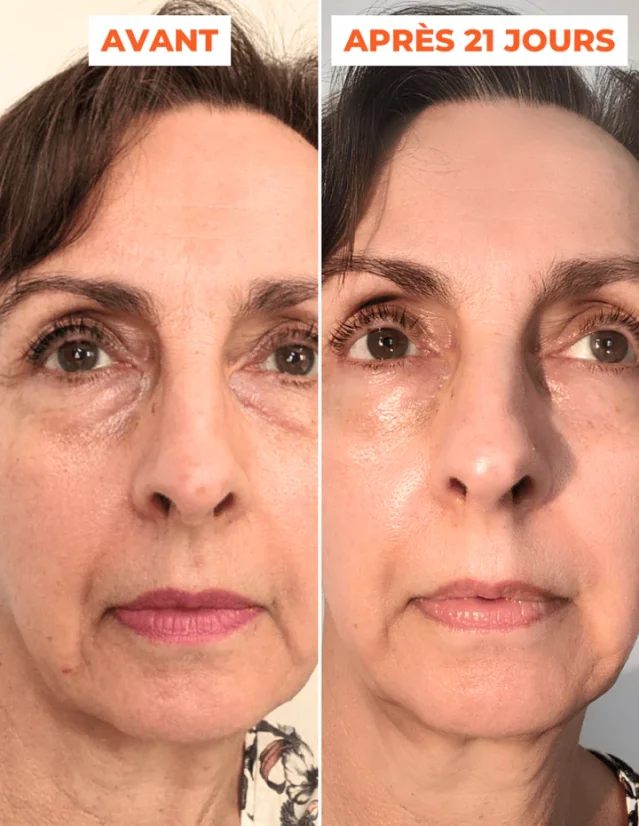 DERMEDEN domácí peeling - Advanced Peel 2 x 30 ml