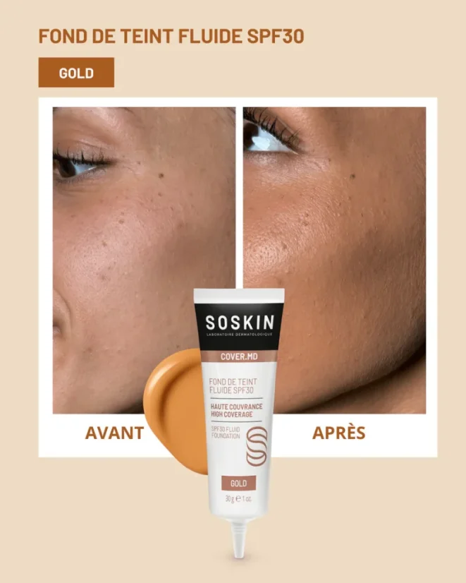 SOSKIN fluidní make-up Fluid SPF30 Gold 30g
