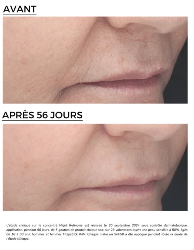 DERMEDEN omlazující noční sérum - Retinal Retinoids 6%  30 ml