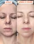 DERMEDEN domácí peeling - Advanced Peel 2 x 30 ml