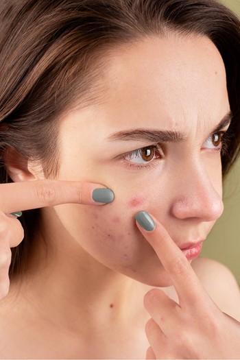 BIRETIX gel na pleť s akné - TRI-ACTIVE GEL 50 ml
