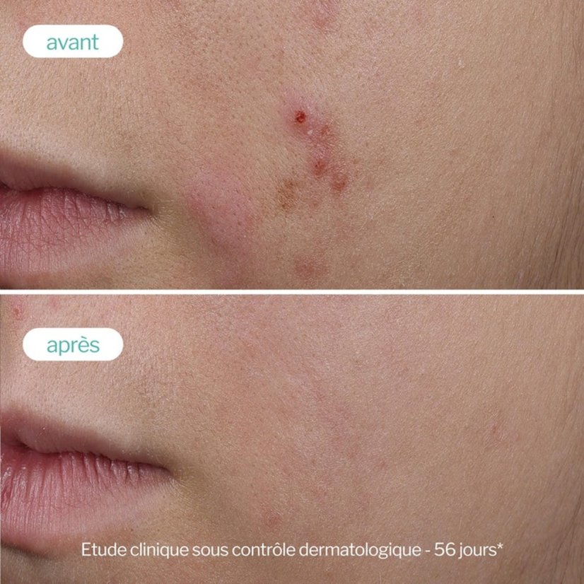 NOVEXPERT pro mastnou a aknózní pleť Trio-Zinc Serum