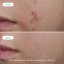 NOVEXPERT pro mastnou a aknózní pleť Trio-Zinc Serum