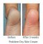 NEOSTRATA - krém pro suchou pokožku Problem Dry Skin Cream 100 g